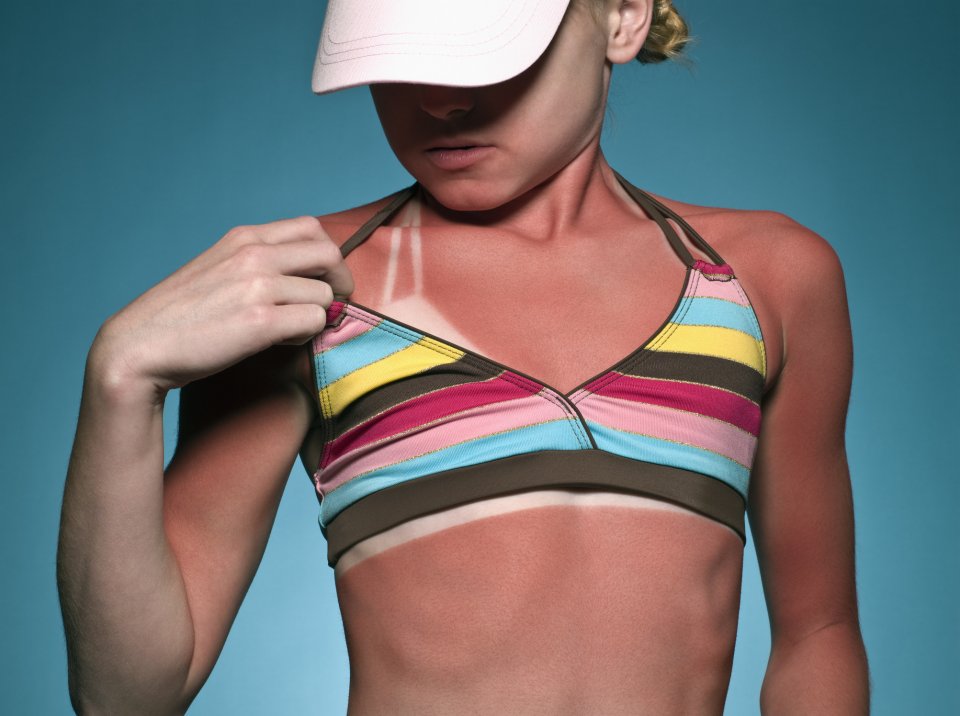 De juiste zonnebrandcreme: kies voor bescherming met UVA- en UVB-factor. Foto: Getty Images