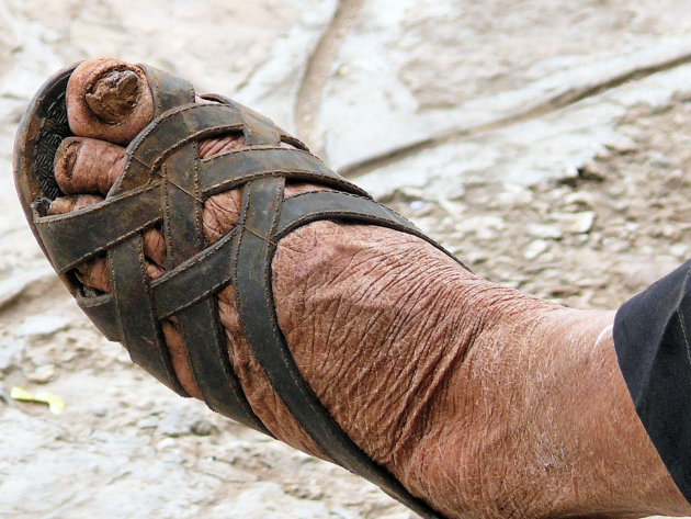 Pedicure? Smaakt dat lekker?