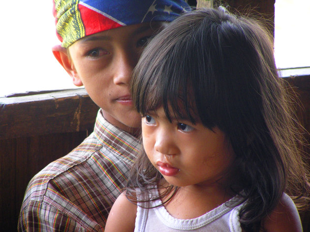 Meisje met hazenlip in Borneo