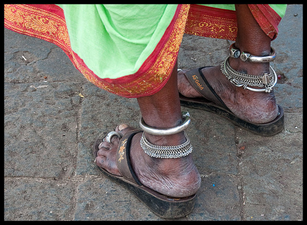 Ankle bracelets