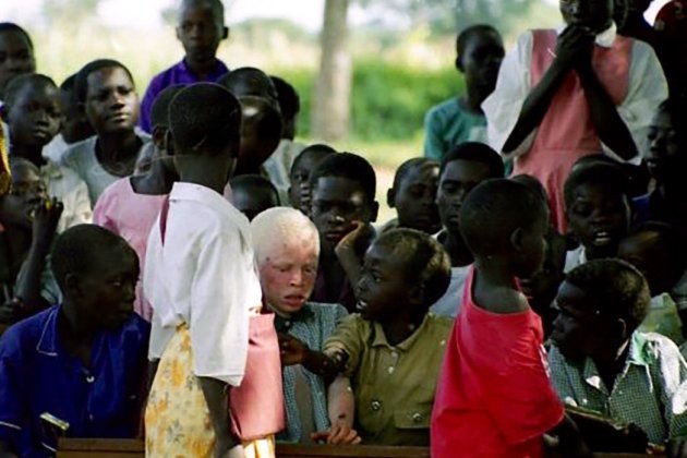 Kind in Uganda